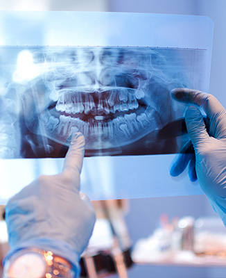 A dental professional is holding up an X-ray of a patient s teeth and jaw, examining it with a magnifying glass.