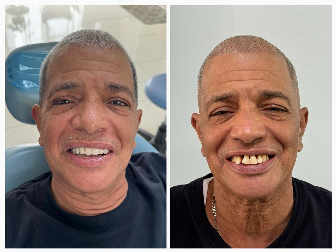 Hyline Dental | CBCT, Snoring Appliances and Root Canals