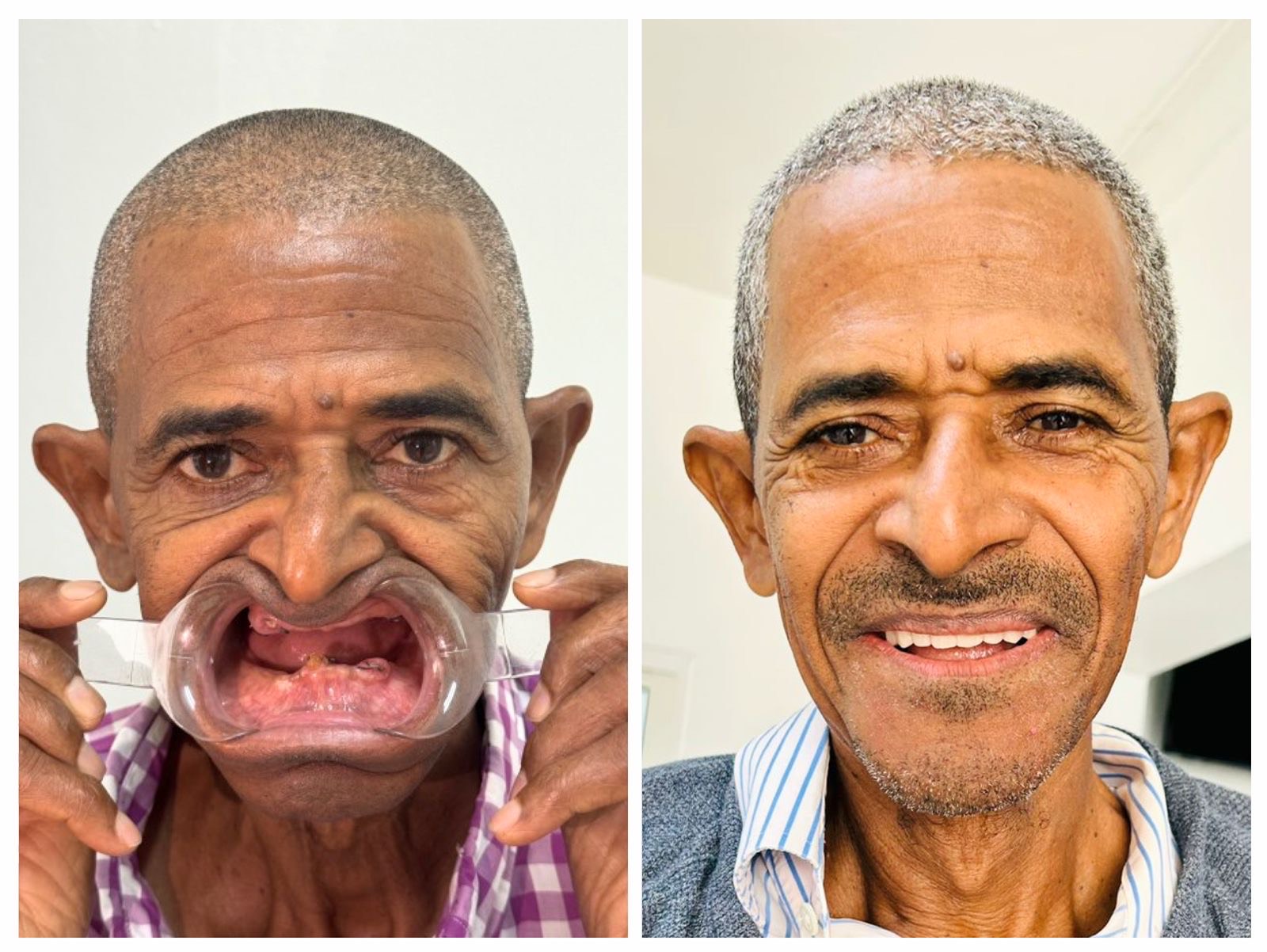 Hyline Dental | Digital Radiography, Preventative Program and Teeth Whitening