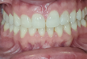 Hy Line Dental | CBCT, Oral Exams and Emergency Treatment