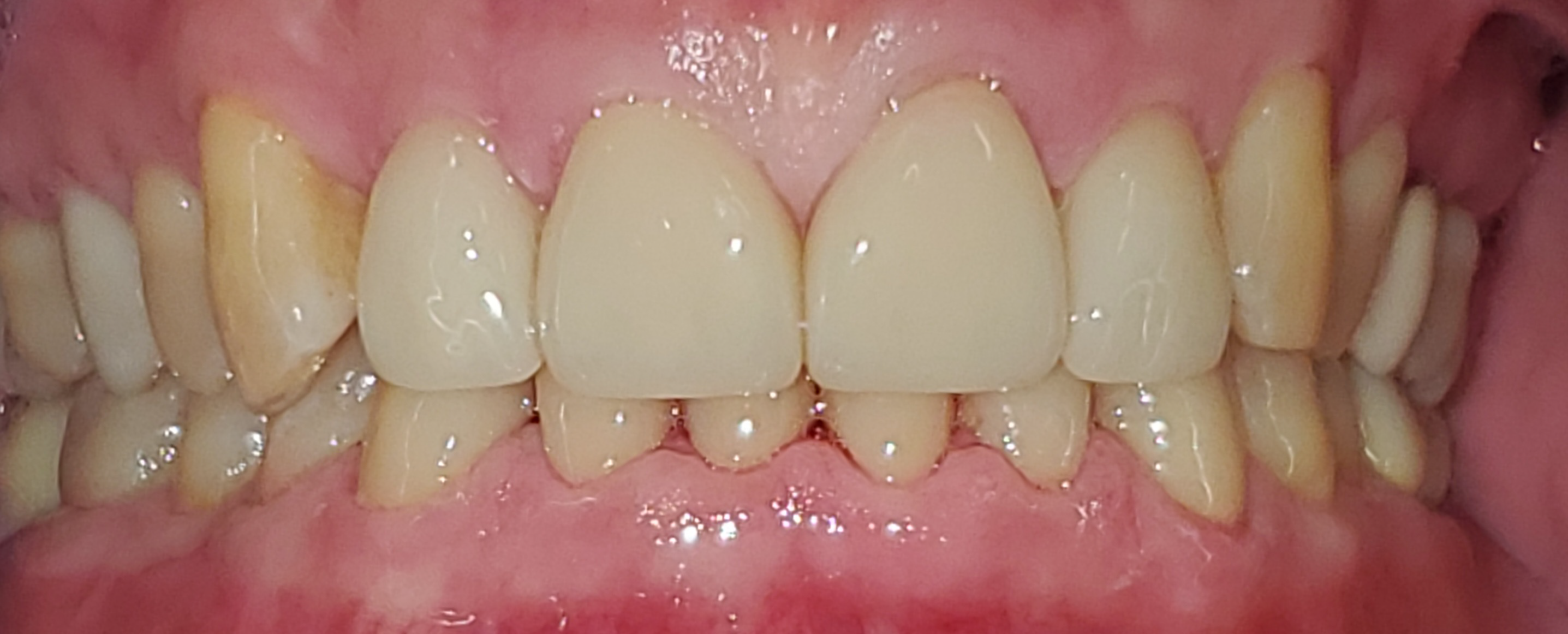 Hyline Dental | Digital Impressions, Oral Exams and Orthodontics