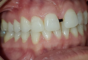 Hy Line Dental | Cosmetic Dentistry, Oral Exams and All-on-6 reg 
