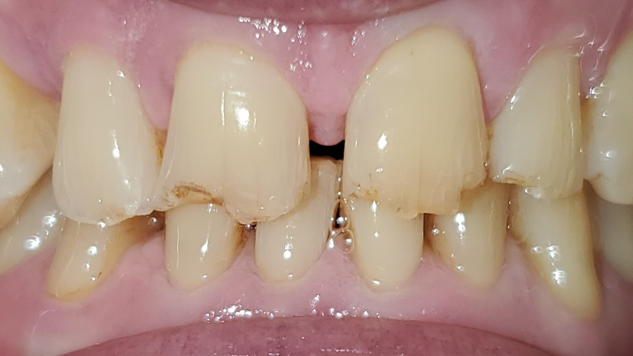 Hyline Dental | Sports Mouthguards, Oral Exams and CBCT