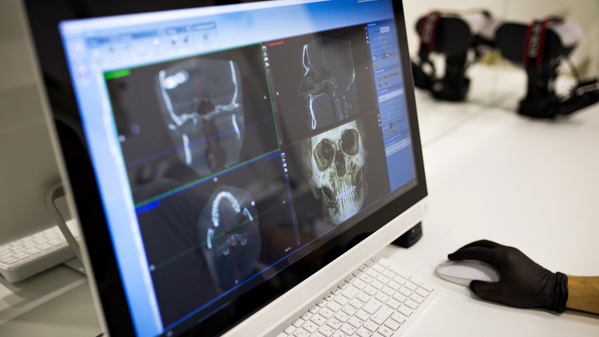 An image of a laptop displaying medical imaging, with various scans and annotations, set against a backdrop that includes a monitor showing the same images being analyzed.