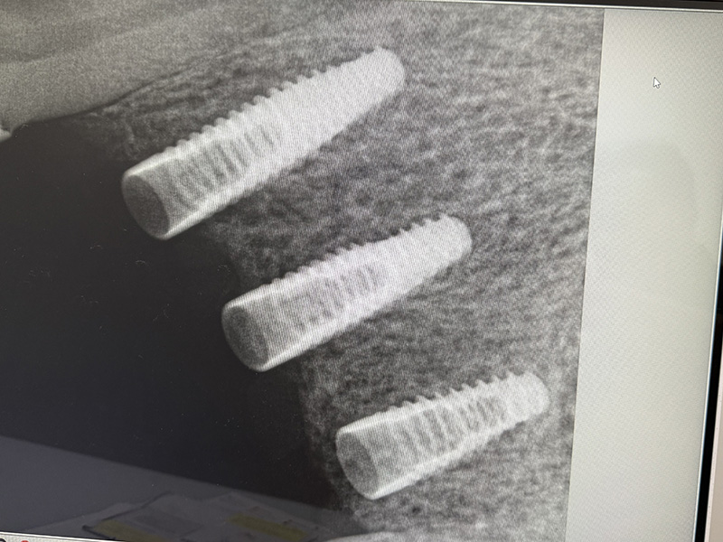 Hyline Dental | Botox reg , Oral Exams and Preventative Program