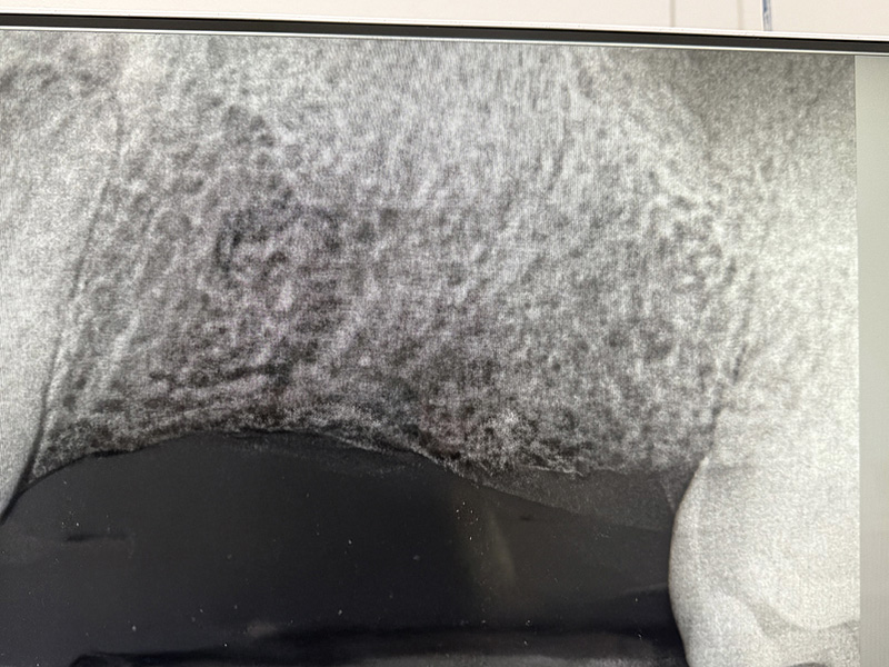 Hyline Dental | Veneers, Botox reg and LANAP reg