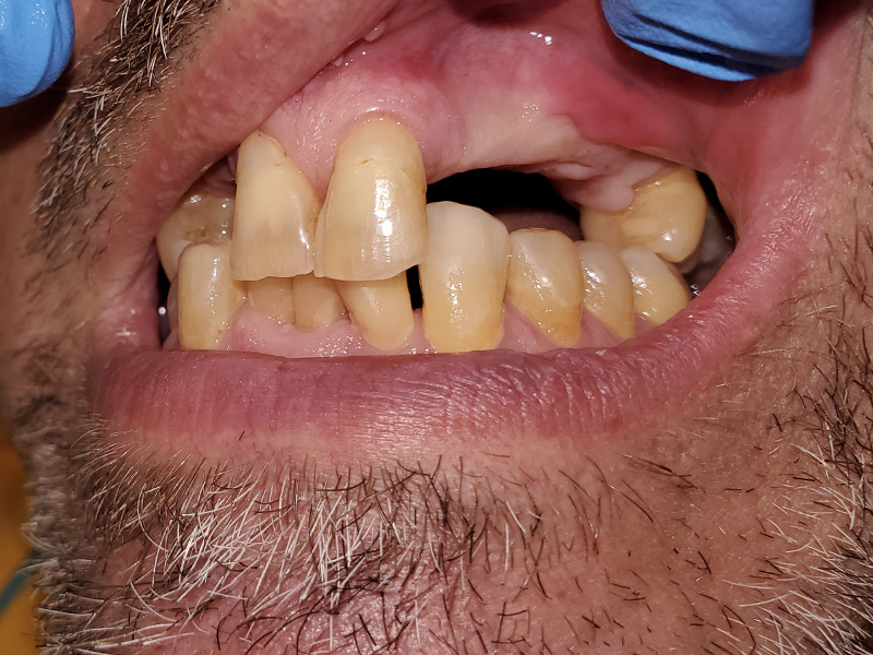 Hyline Dental | Veneers, Braces and Invisalign reg