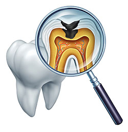 An illustration of a magnified dental model with a focus on the tooth root and pulp, viewed through a magnifying glass, accompanied by an image of a human mouth and teeth.