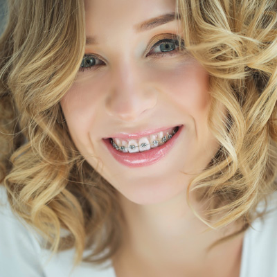 A woman with a bright smile, wearing braces, posing for the camera.