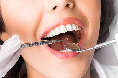 The image shows a smiling woman with a dental device in her mouth, likely a dental impression tray, and she is wearing gloves.