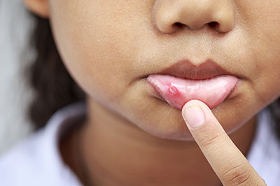 The image shows a close-up of a person s face with a focus on the lips and fingers touching them, indicating the presence of an object or substance on the skin.