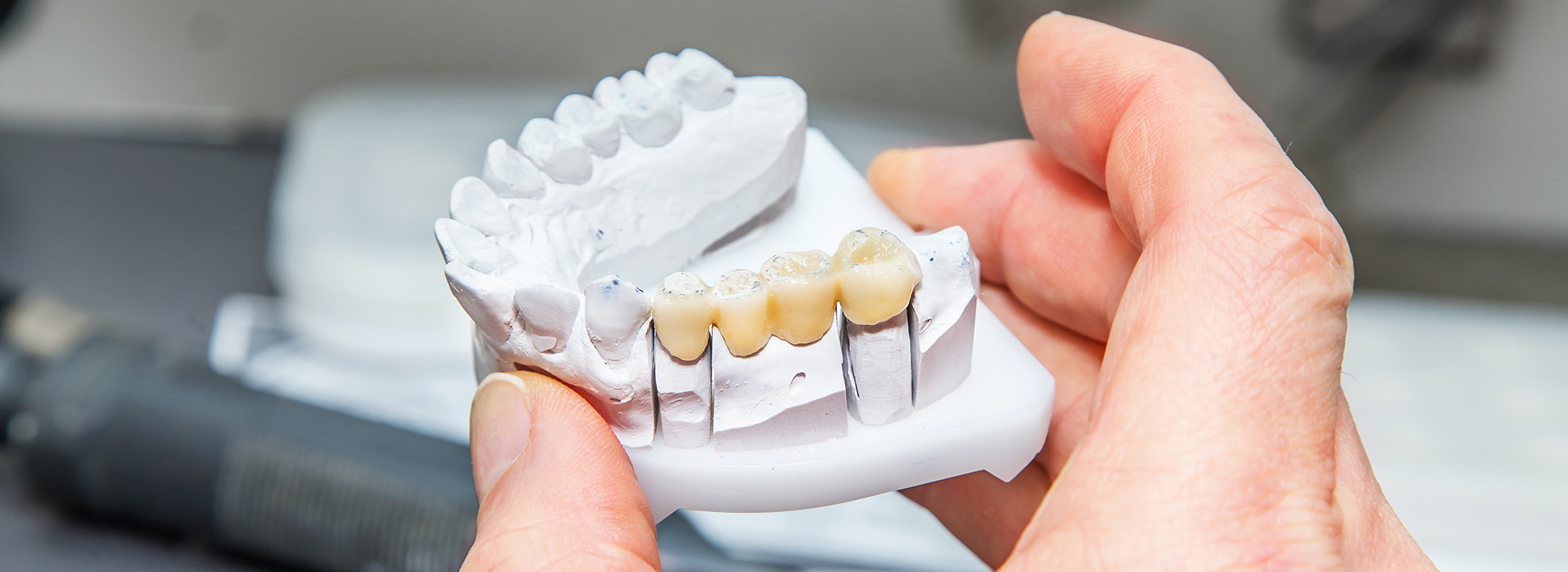 The image features a person holding a 3D printed dental implant, showcasing its design and structure.