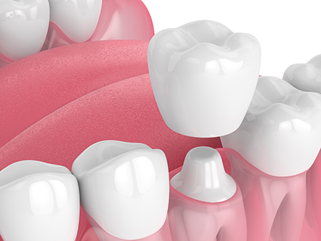 Hyline Dental